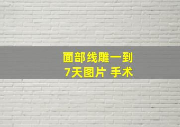 面部线雕一到7天图片 手术